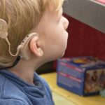 When Was the Cochlear Implant Invented?